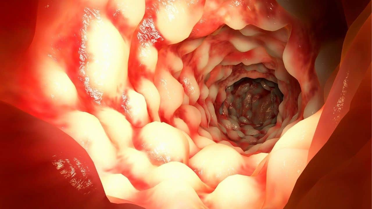 Are Eggs Inflammatory?